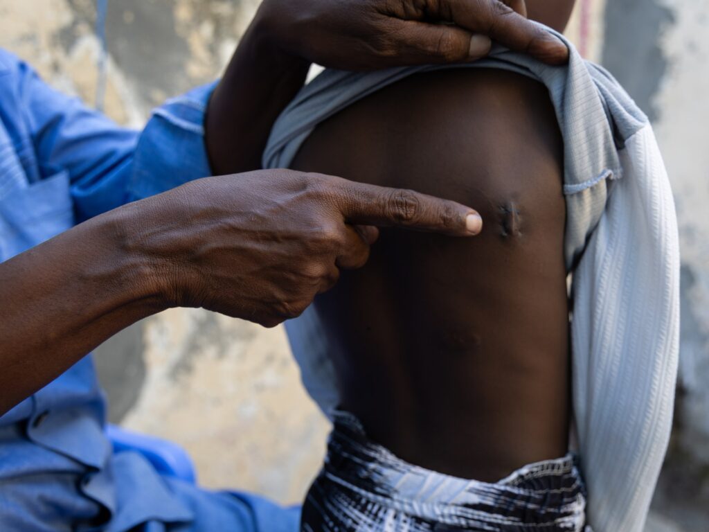 The human cost of surging US air strikes in Somalia | Conflict News